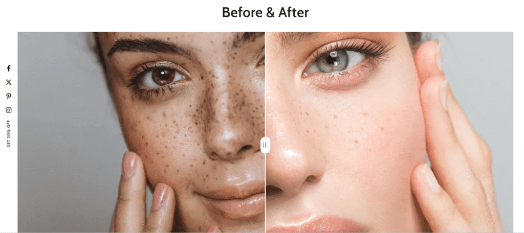 be yours theme before after section